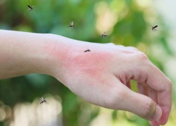 Dikes Dompu Himbau Soal Darurat DBD