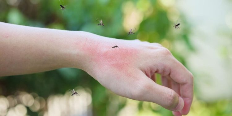 Dikes Dompu Himbau Soal Darurat DBD